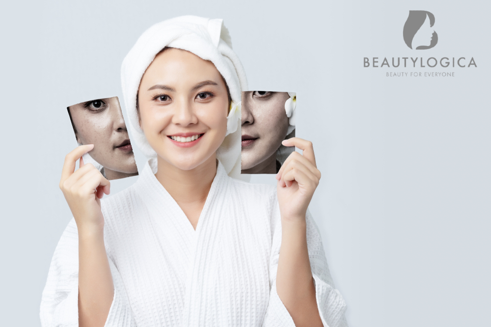 klinik kecantikan beautylogica